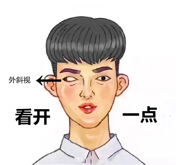 小孩斜视看手机新闻小孩看电视老是歪着头斜眼怎么办