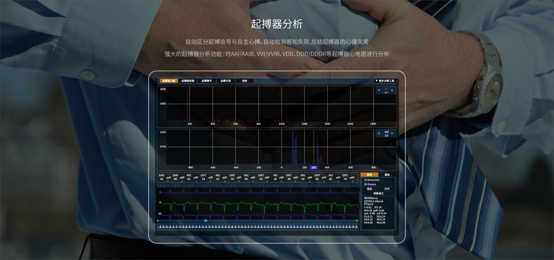 心电图演示软件手机版ECG香港版心电图怎么开-第2张图片-太平洋在线下载